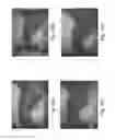 Fig. 15 - Devices and methods for altering eating behavior