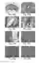 Fig. 26 - Devices and methods for altering eating behavior