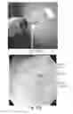 Fig. 30 - Devices and methods for altering eating behavior