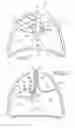 Fig. 02 - Removable anchored lung volume reduction devices and methods