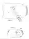 Fig. 03 - Removable anchored lung volume reduction devices and methods