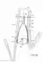 Fig. 06 - Removable anchored lung volume reduction devices and methods