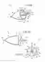 Fig. 07 - Removable anchored lung volume reduction devices and methods