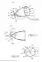 Fig. 08 - Removable anchored lung volume reduction devices and methods