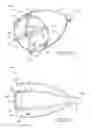 Fig. 10 - Removable anchored lung volume reduction devices and methods