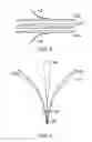 Fig. 04 - DEVICE AND METHOD FOR VASCULAR FILTER