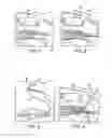 Fig. 02 - Method for knotless fixation of tissue with swivel anchor