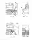 Fig. 07 - Method for knotless fixation of tissue with swivel anchor