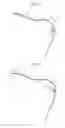 Fig. 05 - Surgical instruments