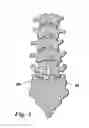 Fig. 02 - Devices and methods for facilitating controlled bone growth or repair