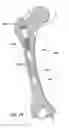 Fig. 07 - Devices and methods for facilitating controlled bone growth or repair