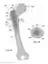 Fig. 08 - Devices and methods for facilitating controlled bone growth or repair