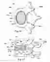 Fig. 09 - Devices and methods for facilitating controlled bone growth or repair