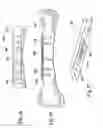 Fig. 12 - Devices and methods for facilitating controlled bone growth or repair