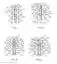 Fig. 04 - METHODS AND SYSTEMS FOR CONSTRAINT OF MULTIPLE SPINE SEGMENTS