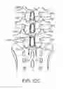Fig. 12 - METHODS AND SYSTEMS FOR CONSTRAINT OF MULTIPLE SPINE SEGMENTS