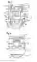 Fig. 03 - Stabilization device for stabilizing vertebrae or bone parts
