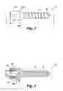 Fig. 03 - Flexible spinal stabilization system and method
