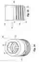 Fig. 06 - Flexible spinal stabilization system and method