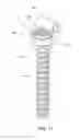Fig. 12 - Method for stabilizing a spine