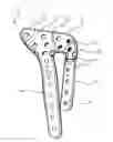 Fig. 01 - Bone plate structure