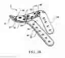 Fig. 04 - Bone plate structure