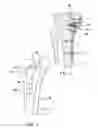 Fig. 06 - Bone plate structure