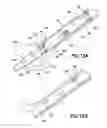 Fig. 08 - BONE FRACTURE TREATMENT DEVICES AND METHODS OF THEIR USE