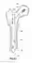 Fig. 18 - BONE FRACTURE TREATMENT DEVICES AND METHODS OF THEIR USE