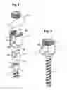Fig. 02 - Polyaxial bone anchoring device