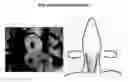 Fig. 01 - ELECTRICAL STIMULATION DEVICE FOR TREATING CARDIOVASCULAR DISEASE AND METHOD FOR TREATING CARDIOVASCULAR  DISEASE