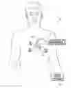 Fig. 01 - Systems and methods for determining optimal interventricular pacing delays based on electromechanical delays