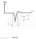 Fig. 12 - Rate initialization and overdrive pacing for capture threshold testing