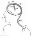 Fig. 01 - Neurostimulation system for selectively estimating volume of activation and providing therapy