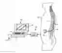 Fig. 01 - Neurostimulation system for estimating desired stimulation amplitude for electrode configuration