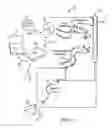 Fig. 02 - Neurostimulation system for estimating desired stimulation amplitude for electrode configuration