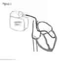 Fig. 02 - Medical electrical lead having biological surface and methods of making and using same