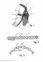 Fig. 02 - Method and device for treatment of mitral insufficiency