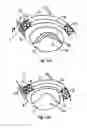 Fig. 07 - Method and device for treatment of mitral insufficiency
