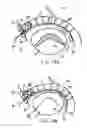Fig. 09 - Method and device for treatment of mitral insufficiency