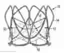 Fig. 01 - Heart valve prosthesis
