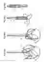 Fig. 07 - Heart valve prosthesis