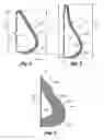 Fig. 02 - COLLAPSIBLE, FORM-STABLE, FILLABLE BREAST PROSTHESIS