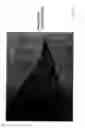 Fig. 22 - NONWOVEN TISSUE SCAFFOLD
