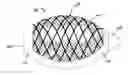 Fig. 01 - Cement-directing orthopedic implants