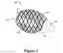 Fig. 02 - Cement-directing orthopedic implants