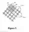 Fig. 06 - Cement-directing orthopedic implants