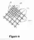 Fig. 07 - Cement-directing orthopedic implants