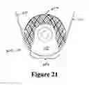 Fig. 22 - Cement-directing orthopedic implants