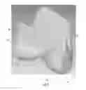 Fig. 02 - ORTHOPEDIC IMPLANT AND METHOD OF MAKING SAME
